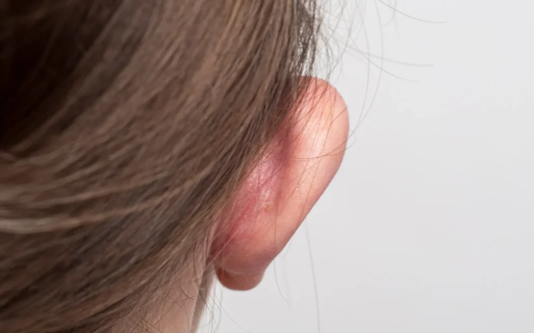 Ohr-Anlege-Operation