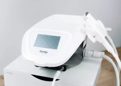 Verbesserung der Laserequipment